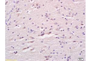 Formalin-fixed and paraffin embedded rat brain labeled with Anti LCAT Polyclonal Antibody, Unconjugated (ABIN676118) at 1:200 followed by conjugation to the secondary antibody and DAB staining
