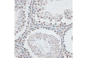 Immunohistochemistry of paraffin-embedded mouse testis using AQR antibody (ABIN6133411, ABIN6137057, ABIN6137058 and ABIN6221662) at dilution of 1:100 (40x lens). (AQR 抗体  (AA 400-700))