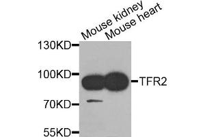 Western blot analysis of extracts of mouse kidney and mouse heart cells, using TFR2 antibody. (Transferrin Receptor 2 抗体)