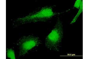 Immunofluorescence of monoclonal antibody to PCGF6 on HeLa cell. (PCGF6 抗体  (AA 225-324))