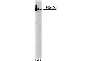 Western blot analysis of IP3R-3 on a HeLa cell lysate. (ITPR3 抗体  (AA 22-230))