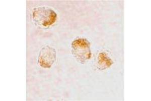 Immunocytochemistry staining of HL-60 cells using BAX polyclonal antibody  at 2 ug/mL . (BAX 抗体  (N-Term))