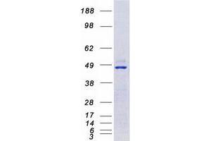 Calcium/calmodulin-Dependent Protein Kinase IV (CAMK4) protein (Myc-DYKDDDDK Tag)