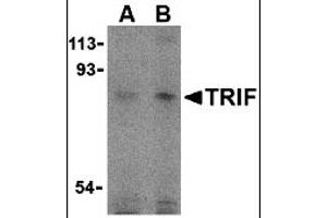 Western Blotting (WB) image for anti-Toll-Like Receptor Adaptor Molecule 1 (TICAM1) (C-Term) antibody (ABIN1030771) (TICAM1 抗体  (C-Term))