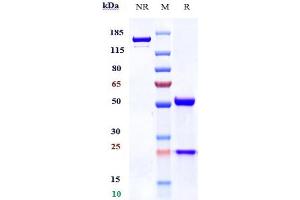 Anti-TNFRSF17 / BCMA / CD269 Reference Antibody (belantamab) on SDS-PAGE under reducing (R) condition.
