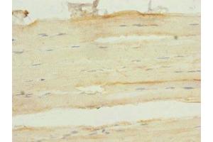 Immunohistochemistry of paraffin-embedded human skeletal muscle tissue using ABIN7153138 at dilution of 1:100 (FHL3 抗体  (AA 1-280))