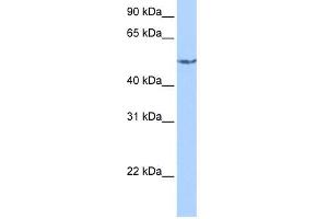 CRAT antibody used at 1 ug/ml to detect target protein.