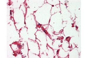 Anti-Complement C3/C3c antibody IHC of human adrenal, adipocytes. (Complement C3c 抗体)