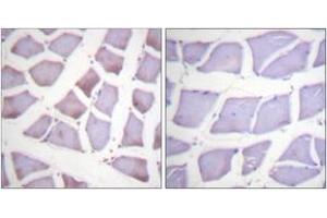 Immunohistochemistry analysis of paraffin-embedded human skeletal muscle tissue, using XIAP (Ab-87) Antibody. (Intestinal Alkaline Phosphatase 抗体  (AA 53-102))