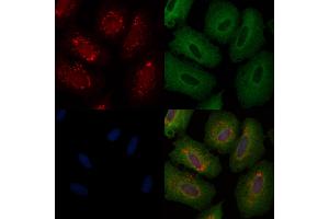 ABIN6257590 and ABIN6274935 staining  cells by IF/ICC. (CHP 抗体  (Internal Region))
