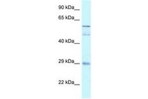 Image no. 1 for anti-GDNF Family Receptor alpha 4 (GFRA4) (AA 182-231) antibody (ABIN6747540) (GFRA4 抗体  (AA 182-231))