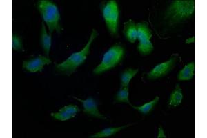 Immunofluorescence staining of U251 cells with ABIN7156223 at 1:50, counter-stained with DAPI. (IVNS1ABP 抗体  (AA 401-642))