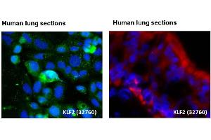 Immunohistochemistry (IHC) image for anti-Kruppel-Like Factor 2 (Lung) (KLF2) (Middle Region) antibody (ABIN2777573)