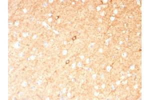Formalin-fixed, paraffin-embedded human Brain stained with GAD1 (GAD67) Mouse Monoclonal Antibody (GAD1/2391). (GAD 抗体  (AA 72-135))