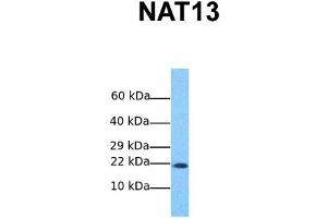 Host:  Rabbit  Target Name:  NAT13  Sample Tissue:  Human MCF7  Antibody Dilution:  1. (NAA50 抗体  (C-Term))