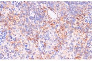 Immunohistochemistry of paraffin-embedded Rat spleen using NT5E / CD73 Polyclonal Antibody at dilution of 1:200 (40x lens). (CD73 抗体)