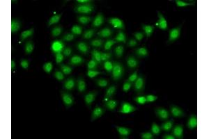 Immunofluorescence analysis of A-549 cells using COPS2 antibody (ABIN6130123, ABIN6138877, ABIN6138878 and ABIN6222819). (COPS2 抗体  (AA 1-310))