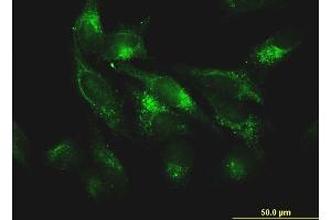 Immunofluorescence of monoclonal antibody to FTL on HeLa cell.