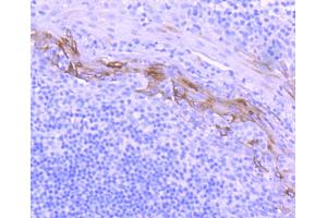 Paraformaldehyde-fixed, paraffin embedded human tonsil, Antigen retrieval by boiling in sodium citrate buffer (pH6) for 15min, Block endogenous peroxidase by 3% hydrogen peroxide for 30 minutes, Blocking buffer at 37°C for 20min, Antibody incubation with Cytokeratin 10 (1D8) Monoclonal Antibody  at 1:50 overnight at 4°C, followed by a conjugated secondary and DAB staining. (Keratin 10 抗体)