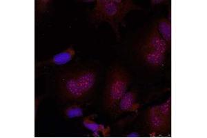 Image no. 2 for anti-Jun B Proto-Oncogene (JUNB) (pSer79) antibody (ABIN196657) (JunB 抗体  (pSer79))