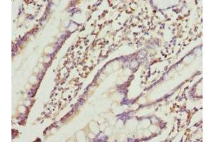 Immunohistochemistry of paraffin-embedded human small intestine tissue using ABIN7167209 at dilution of 1:100 (GTR2 抗体  (AA 1-250))
