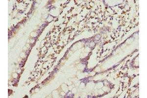 Immunohistochemistry of paraffin-embedded human small intestine tissue using ABIN7167209 at dilution of 1:100 (GTR2 抗体  (AA 1-250))