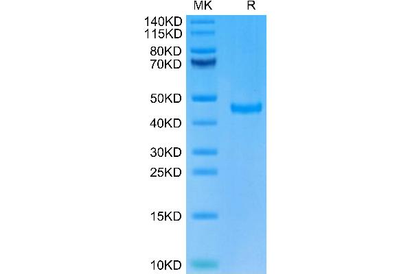 SPARC Protein (AA 18-303) (His tag)