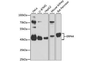Western blot analysis of extracts of various cell lines, using ERP44 antibody (ABIN6291618) at 1:3000 dilution. (ERP44 抗体)