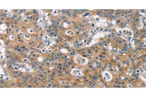 Immunohistochemistry (Paraffin-embedded Sections) (IHC (p)) image for anti-Clathrin Heavy Chain (CLTC) antibody (ABIN7238828)