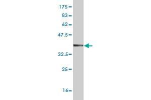 Western Blot detection against Immunogen (36. (DYRK2 抗体  (AA 1-100))