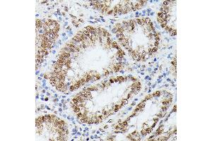 Immunohistochemistry of paraffin-embedded human colon using KIF22 antibody  at dilution of 1:100 (40x lens). (KIF22 抗体  (AA 456-665))