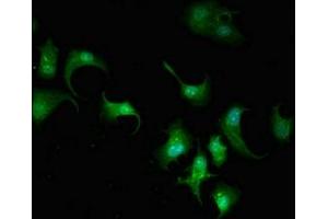 Immunofluorescent analysis of MCF-7 cells using ABIN7143098 at dilution of 1:100 and Alexa Fluor 488-congugated AffiniPure Goat Anti-Rabbit IgG(H+L) (ARPC5L 抗体  (AA 15-124))
