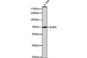 Western blot analysis of extracts of A-549 cells using IL3RA Polyclonal Antibody at dilution of 1:1000. (IL3RA 抗体)