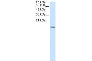 WB Suggested Anti-HDAC6 Antibody Titration:  0. (HDAC6 抗体  (N-Term))