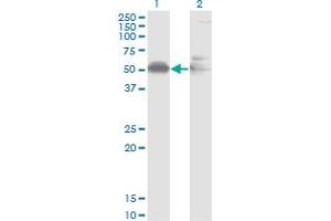 Western Blot analysis of AHSG expression in transfected 293T cell line by AHSG monoclonal antibody (M02), clone 1D8. (Fetuin A 抗体  (AA 19-367))