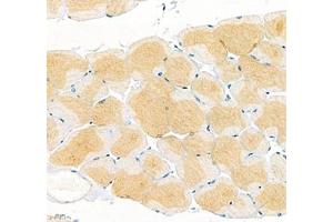 Immunohistochemistry of paraffin embedded mouse skeletal muscle using Junctophilin2 (ABIN7074393) at dilution of 1: 600 (400x lens) (Junctophilin 2 抗体)