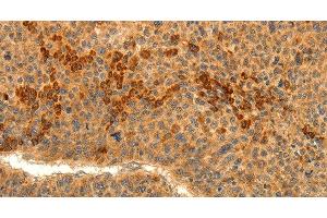 Immunohistochemistry (Paraffin-embedded Sections) (IHC (p)) image for anti-Transient Receptor Potential Cation Channel, Subfamily M, Member 7 (TRPM7) antibody (ABIN7238456)
