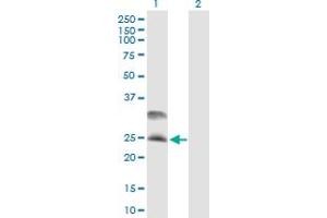 Western Blotting (WB) image for anti-DnaJ (Hsp40) Homolog, Subfamily C, Member 5 (DNAJC5) (AA 1-198) antibody (ABIN529280)