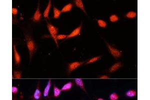 Immunofluorescence (IF) image for anti-Methyltransferase Like 3 (METTL3) antibody (ABIN7264399)