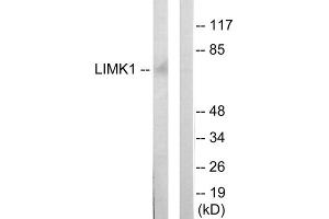 Western blot analysis of extracts from mouse brain cells, using LIMK1 antibody. (LIM Domain Kinase 1 抗体  (Internal Region))