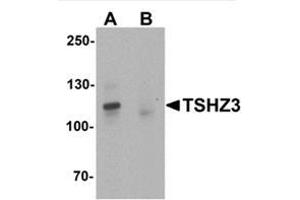 Western blot analysis of TSHZ3 in mouse brain tissue lysate with TSHZ3 / ZNF537 Antibody at 1 µg/ml in (A) the absence and (B) the presence of blocking peptide. (TSHZ3 抗体  (N-Term))