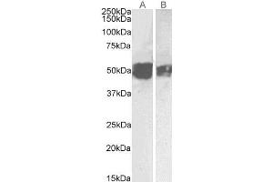 Western Blotting (WB) image for anti-Glial Fibrillary Acidic Protein (GFAP) (C-Term) antibody (ABIN185730)