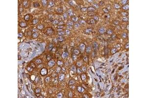 ABIN6268689 at 1/100 staining human breast tissues sections by IHC-P. (HMOX2 抗体  (Internal Region))
