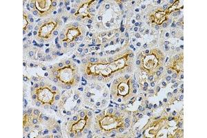Immunohistochemistry of paraffin-embedded Mouse kidney using ADRBK1 Polyclonal Antibody at dilution of 1:200 (40x lens). (GRK2 抗体)