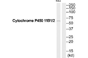 Western blot analysis of extracts from COLO205 cells, using Cytochrome P450 11B1/2 antibody. (Cytochrome P450 11B1/2 (C-Term) 抗体)
