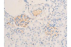 Immunohistochemistry (IHC) image for anti-Receptor tyrosine-protein kinase erbB-2 (ErbB2/Her2) (pTyr1112) antibody (ABIN6255774)