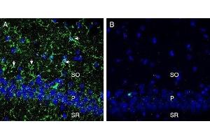 Expression of CX3CR1 in rat hippocampus - Immunohistochemical staining of perfusion-fixed frozen rat brain sections with Anti-CX3CR1 (extracellular) Antibody (ABIN7043047, ABIN7044194 and ABIN7044195), (1:300), followed by goat anti-rabbit-AlexaFluor-488. (CX3CR1 抗体  (Extracellular))