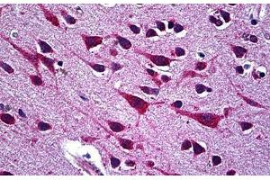 Human Brain, Cortex: Formalin-Fixed, Paraffin-Embedded (FFPE) (CCT5 抗体  (AA 1-542))