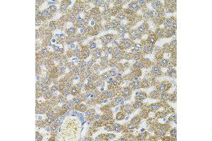 Immunohistochemistry of paraffin-embedded rat liver using CEP164 antibody. (CEP164 抗体)