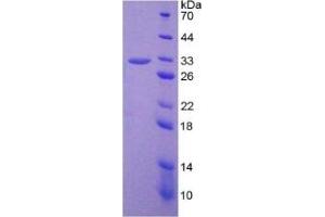 SDS-PAGE of Protein Standard from the Kit (Highly purified E. (PTGS2 ELISA 试剂盒)